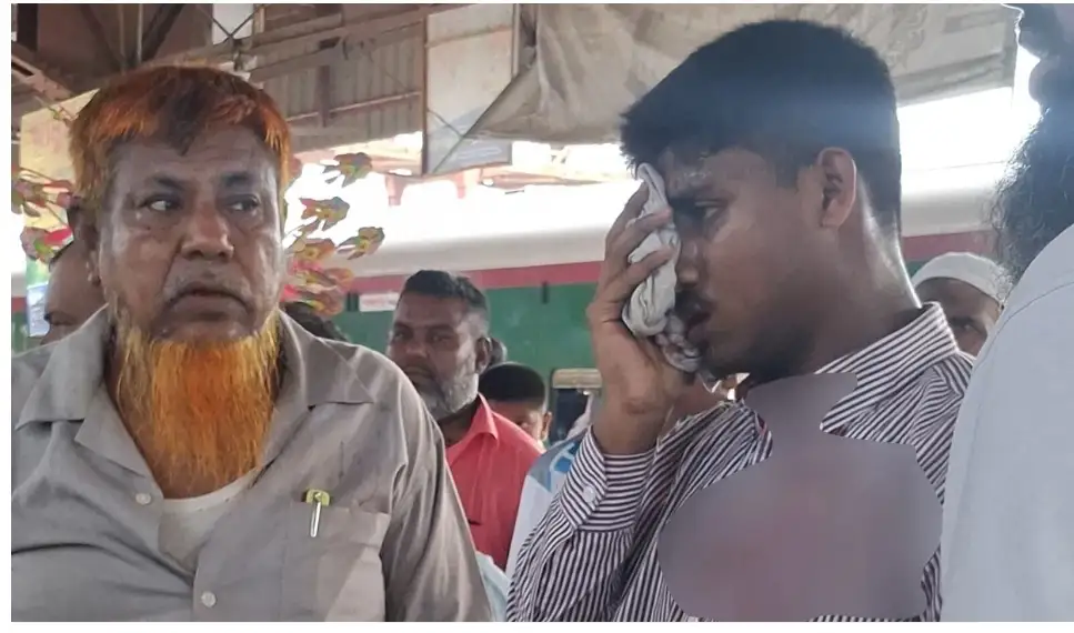 সিরাজগঞ্জে চলন্ত ট্রেনে পাথর নিক্ষেপ, এক চোখ হারালেন এইচএসসি শিক্ষার্থী সাব্বির!