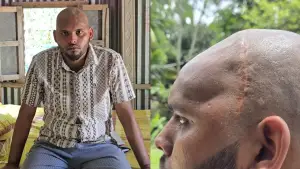 তিন গু/লির আঘা/তেও বেঁচে ফিরেছেন; তবু স্বাভাবিক জীবনে ফিরতে পারেননি জুলাই যো/দ্ধা ইমরান