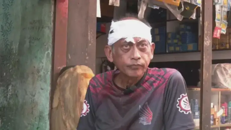 যশোরে বাড়ির সামনে হামলার শিকার অভিনেতা সমু চৌধুরী, মাথায় লাগলো চার সেলাই